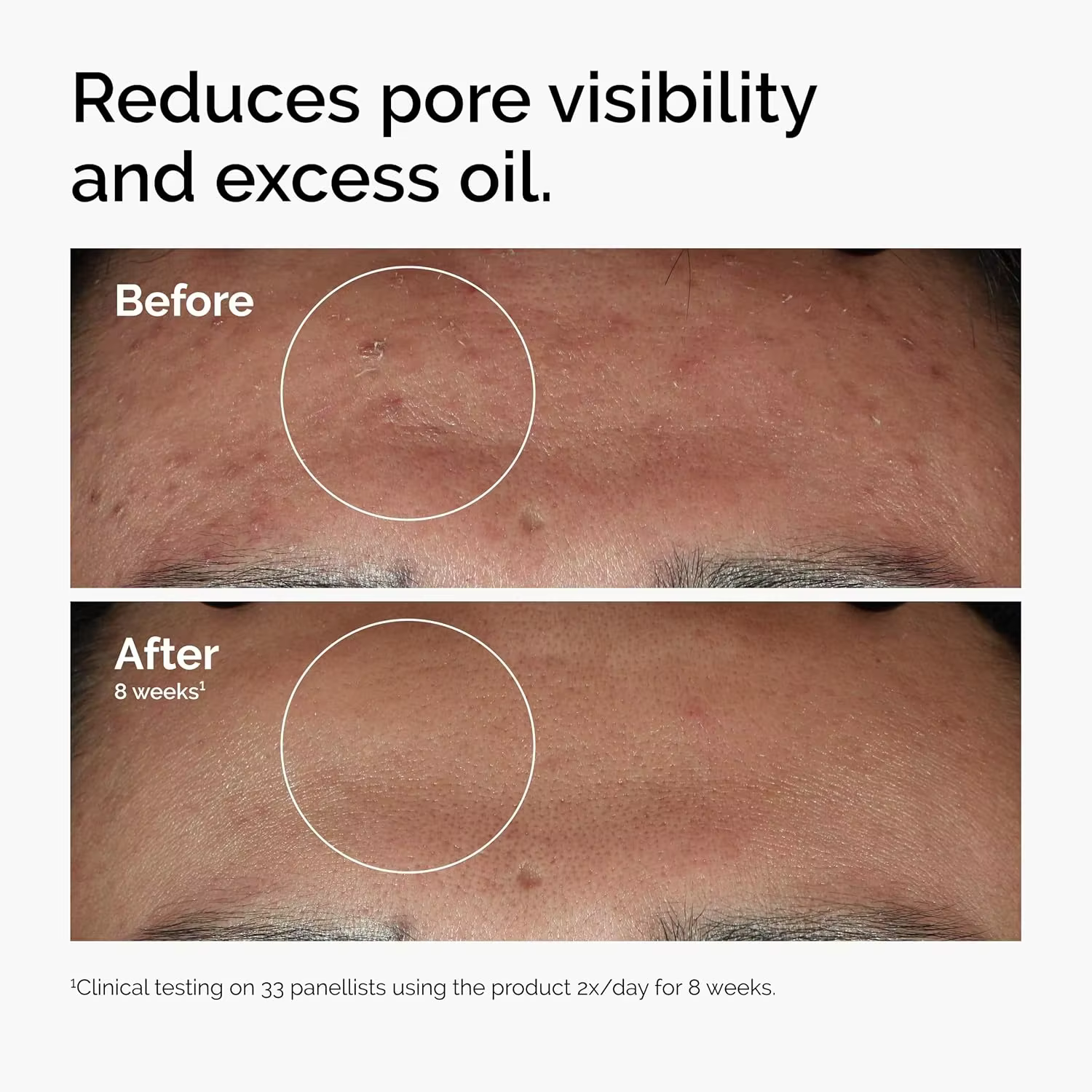 Sérum visage hydratant 30ml Acide Hyaluronique 2% + B5 & Niacinamide 10% + Zinc 1% pour une peau lisse