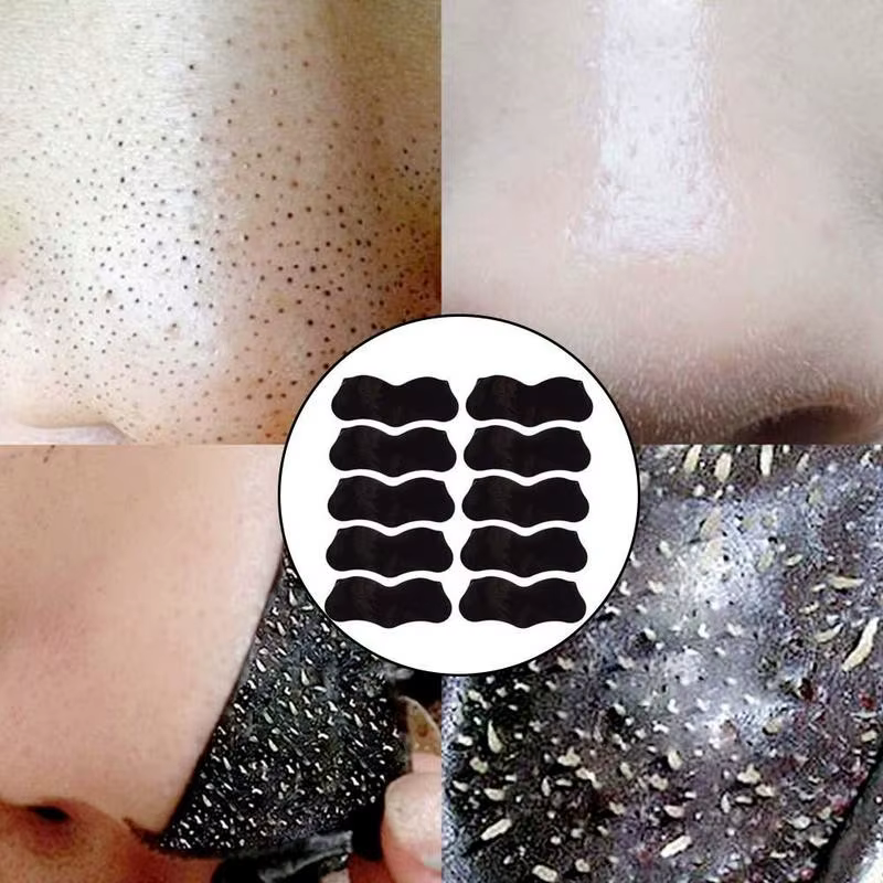 Nez points noirs dissolvant masque bandes nasales tête noire nez