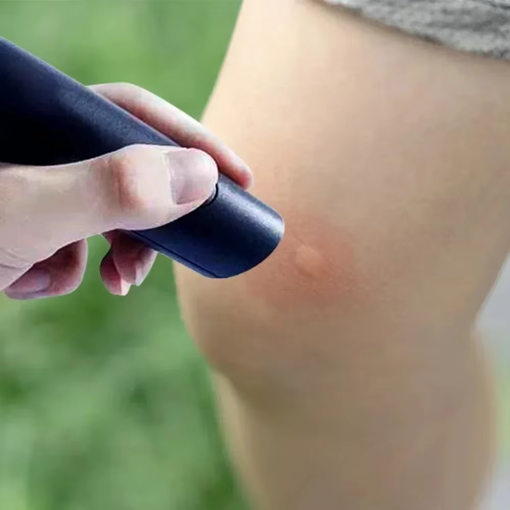 Stylo électronique anti-moustiques portable, soulagement des démangeaisons, des gonflements et de la douleur, outil de soulagement des piqûres d'insectes, pour le camping en plein air, les voyages, l'