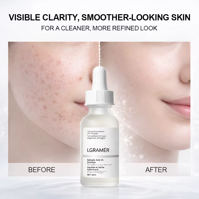 Sérum facial à 2% d'acide salicylique