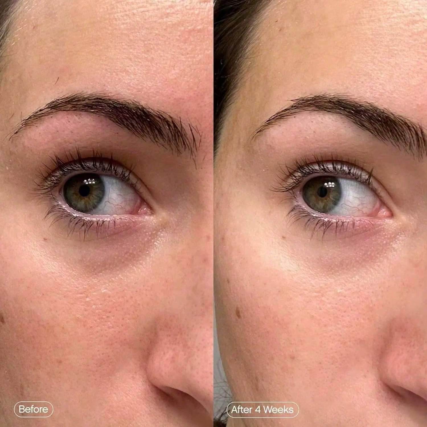Démoloration et éclaircit le masque facial | activer les patchs