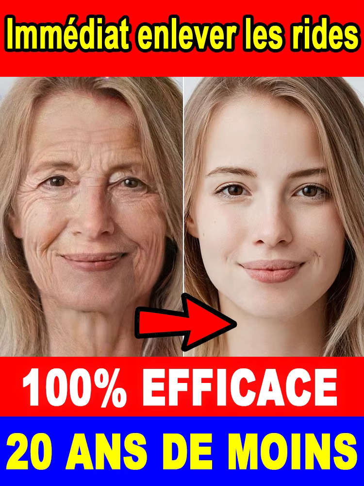 20 ans plus jeunes, pas de ridules