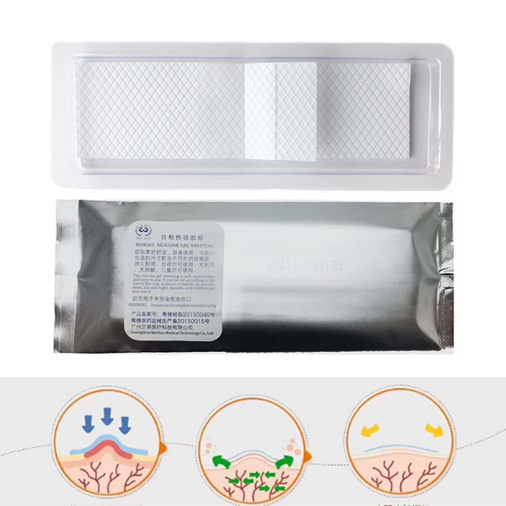 12 cm x 3.5 cm blanc élimination césarienne Silicone cicatrice Patch feuille de Gel marques de plaies cicatrices de peau traitement de thérapie 1 pièces