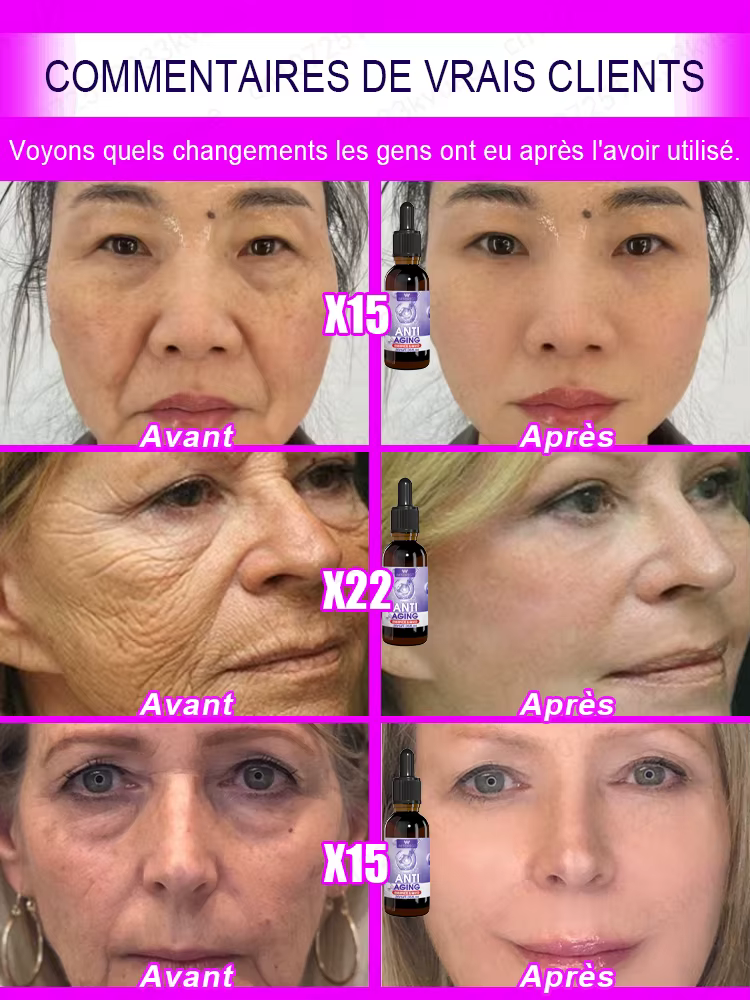 Pas de rides, 20 ans plus jeune
