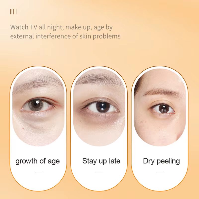 SADOER vitamine C crème pour les yeux raffermissant hydratant éclaircissant Anti cernes sacs