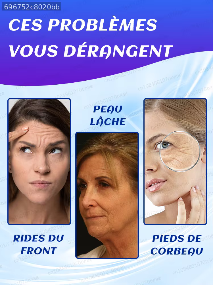 Rides n° Peau semblable à une coquille d'œuf, peau lisse et saine