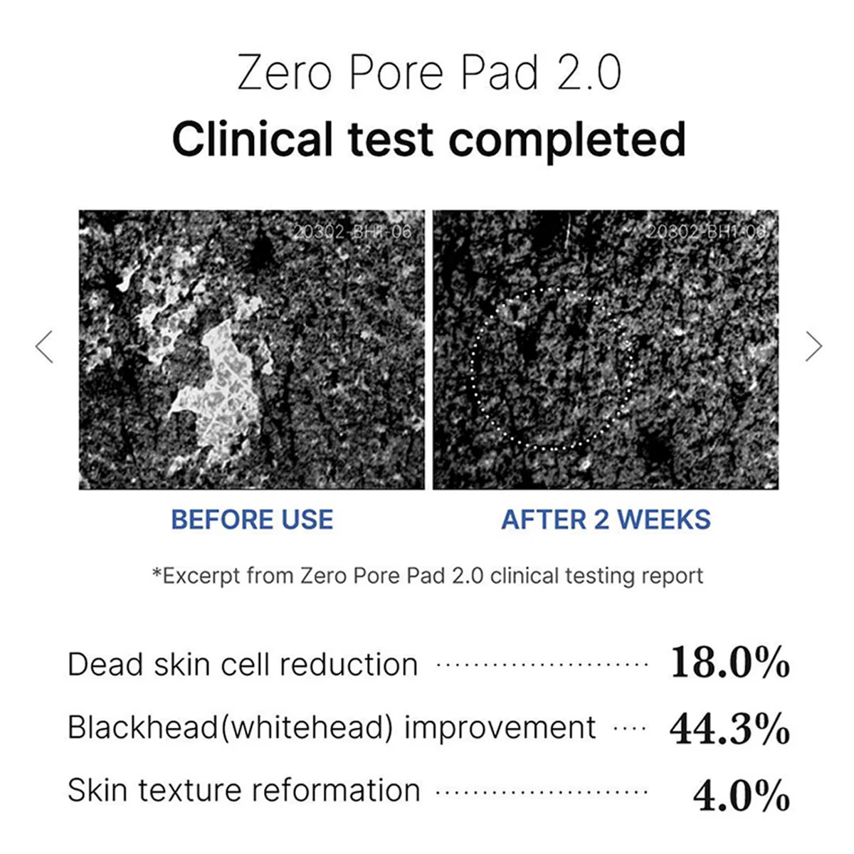 Medicube ZERO PORE PAD 2.0