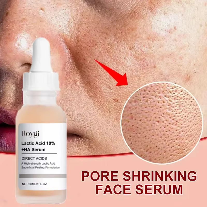 Acide lactique rétrécit les Pores sérum rapide grands