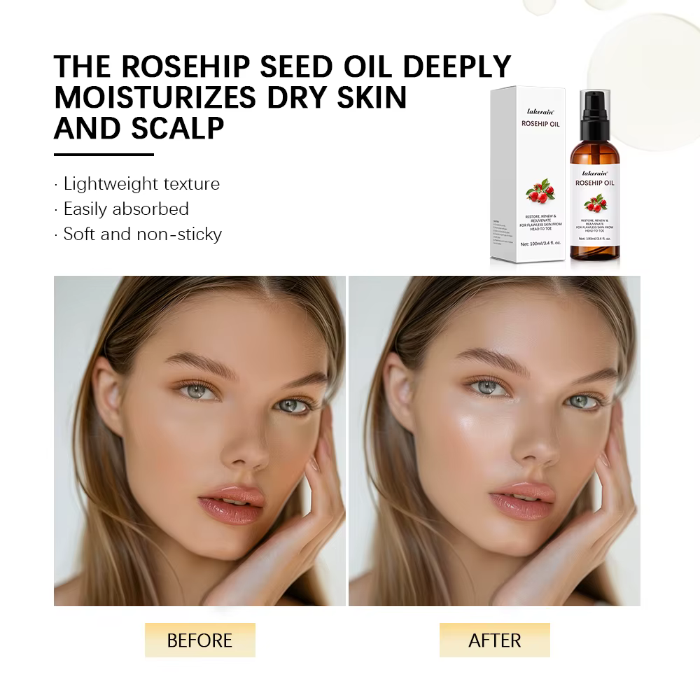 Huile de rose musquée biologique