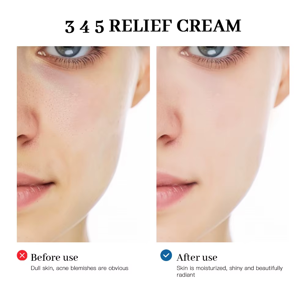 345 crème de soulagement solution complète pour les problèmes de peau Anti-ouille et antioxydant éclaircissant