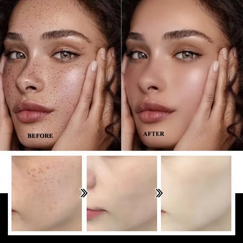 Crème éclaircissante douce à la niacinamide pour la peau