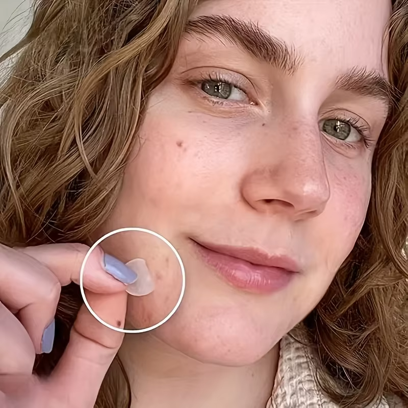 36 patchs hydrocolloïdes contre l'acné – Absorbant le Pus & Oil