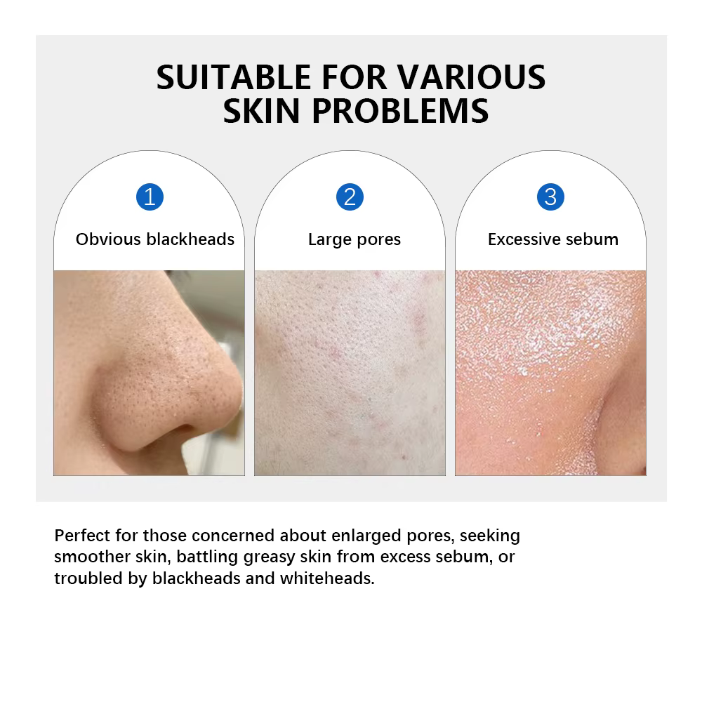 Lakerain – Lot de 2 produits de soin : Tampon tonifiant 0-Pore, Sérum éclat au peptide rose et ADN de saumon, Hydratant purifiant au beurre de karité