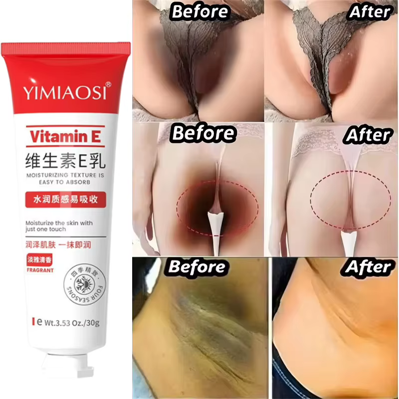 Crème Éclaircissante Vitamine E Anti-Mélanine pour Peaux Foncées – Efficace pour Éclaircir les Cuisses et Zones Intimes