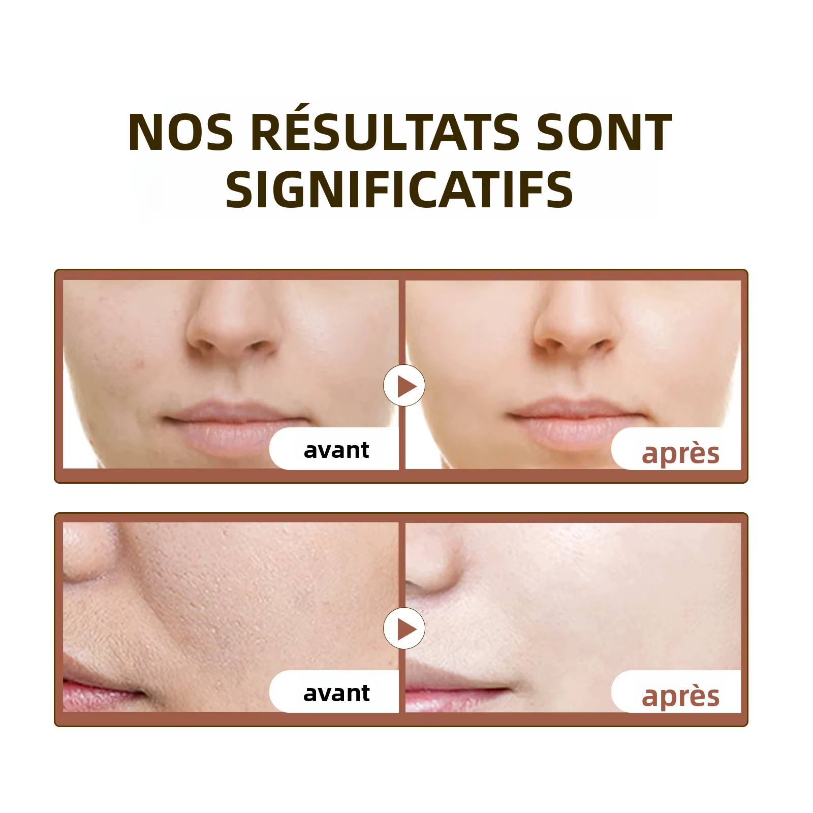 Sérum apaisant à la Centella Asiatica 55ml - Formule de Madagascar