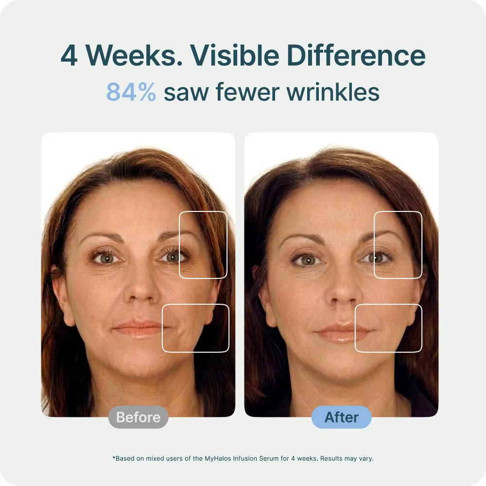 Kit de Microneedling à l'Acide Hyaluronique et au Collagène Anti-Âge Hydratant Raffermissant Nettoyant les Pores Soin du Visage
