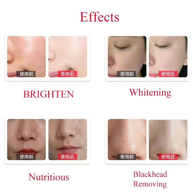 Solution professionnelle dermabrasion
