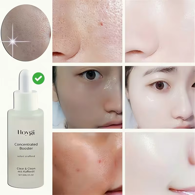 Sérum pour nettoyer les Pores du visage