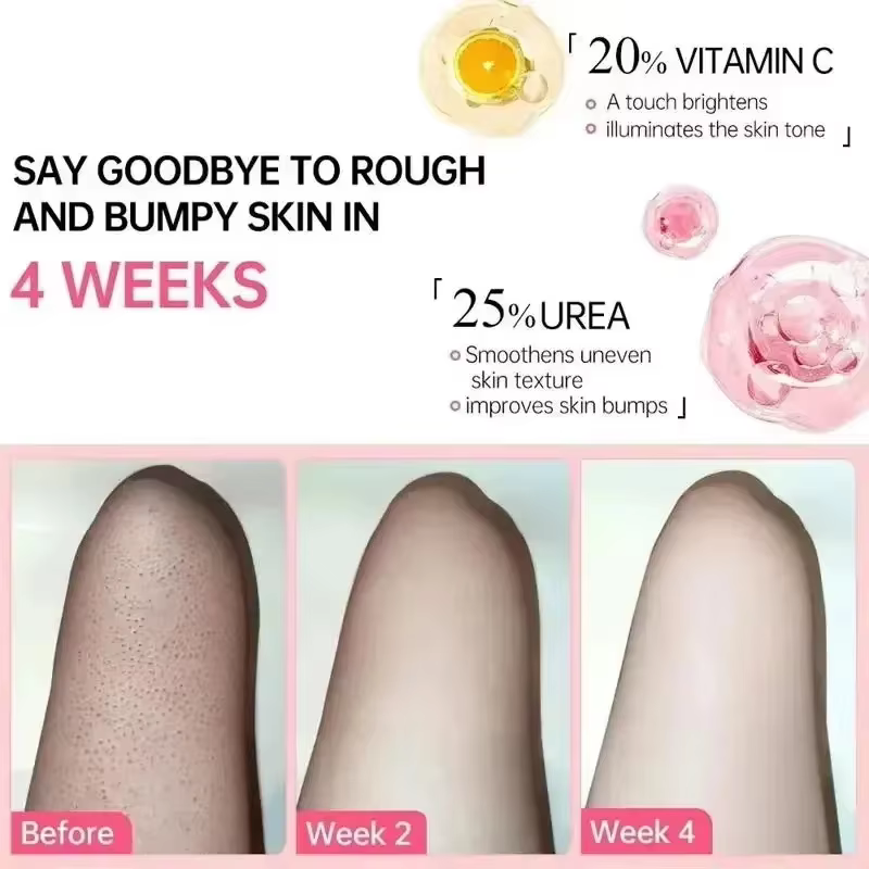 Crème Éclaircissante Vitamine E Anti-Mélanine pour Peaux Foncées – Efficace pour Éclaircir les Cuisses et Zones Intimes