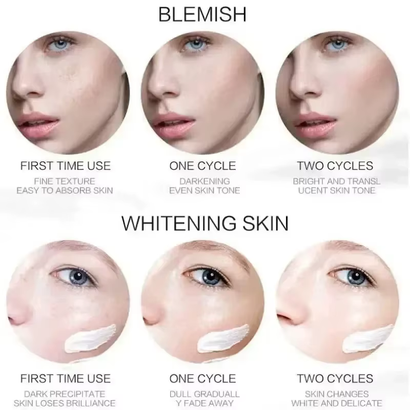 1/3/5 pièces crème blanchissante pour les taches de rousseur Niacinamide élimine