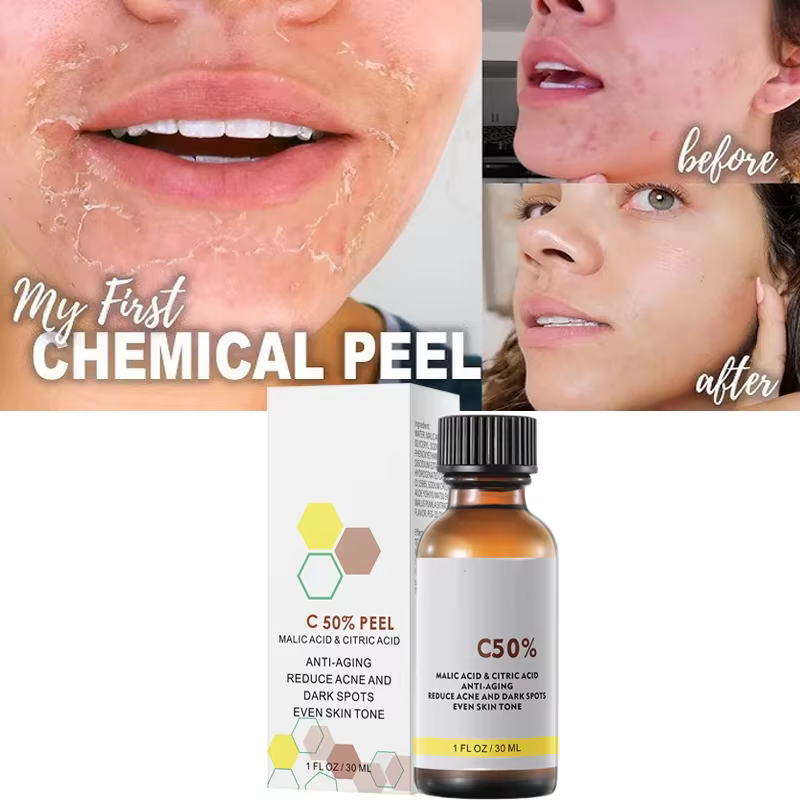 Mélanine de soins du visage pour une peau plus éclatante