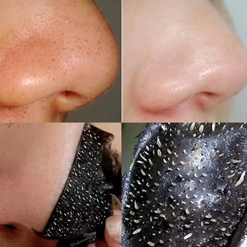 Masque anti-points noirs au charbon de bambou