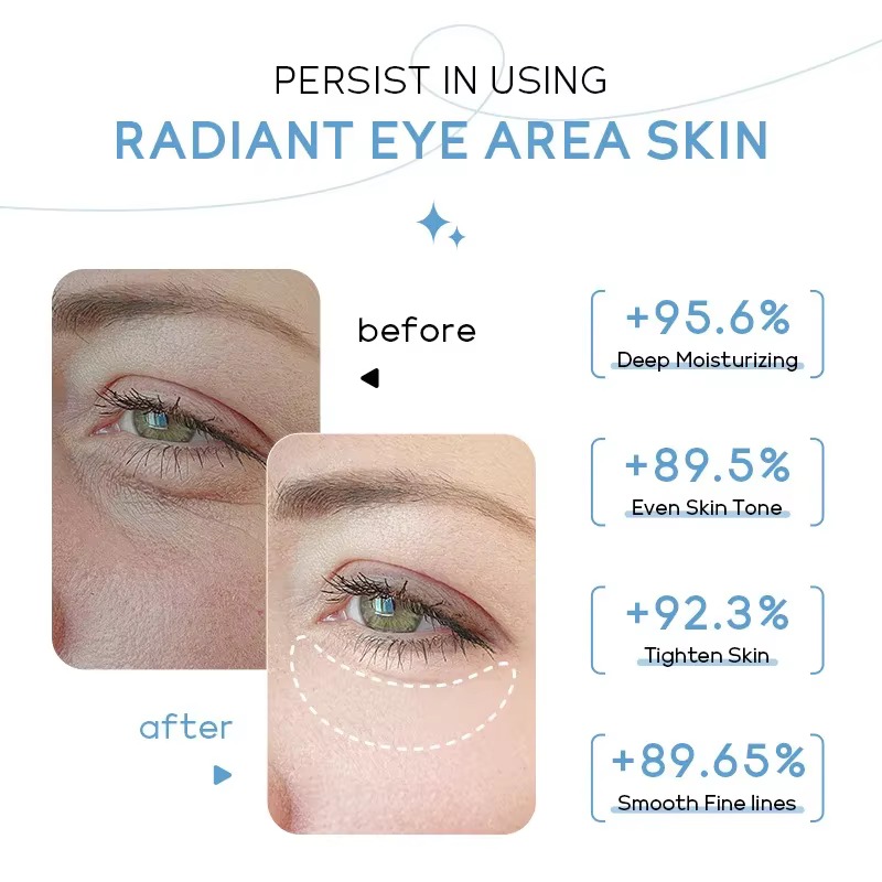 Crème Contour des Yeux LAIKOU au Lait Hydratante Éclaircissante Anti-Cernes Anti-Poches Atténue les Ridules Massage
